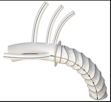 FDA Approves Aortic Dissection Hybrid Device