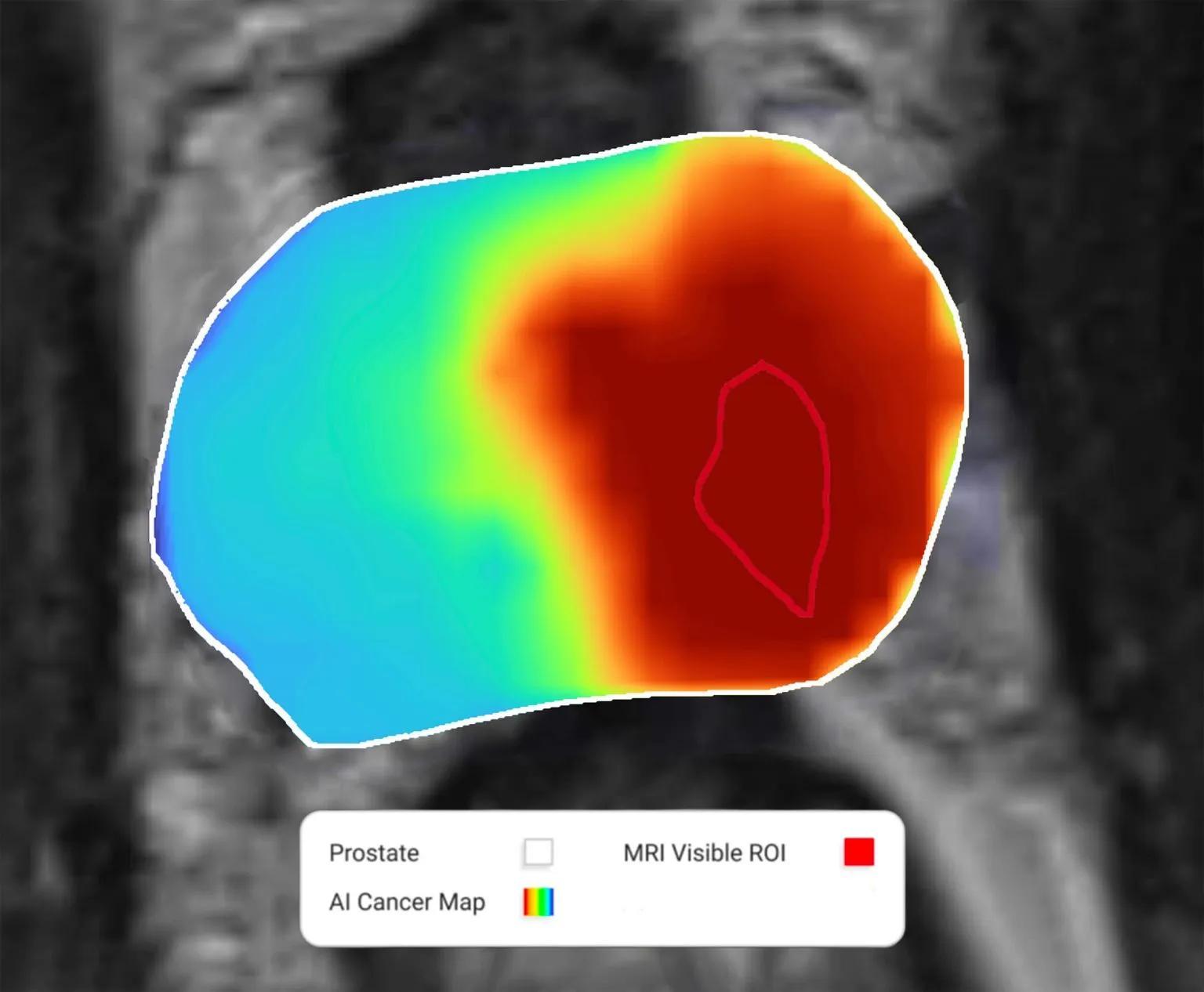 Cancer Management Platform Receives FDA Clearance